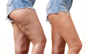 Come-dimagrire-e-combattere-la-cellulite-oli-essenziali